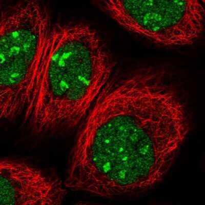 Immunocytochemistry/ Immunofluorescence: PTMS Antibody [NBP1-80948]