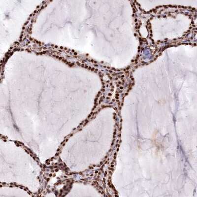 Immunohistochemistry-Paraffin: PTMS Antibody [NBP1-80948]