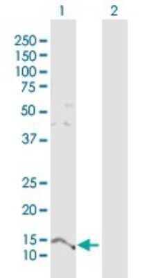 Western Blot: PTMS Antibody [H00005763-D01P]