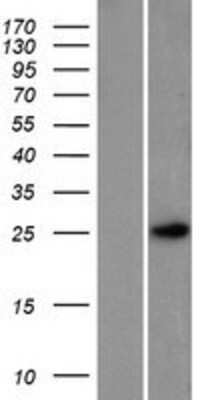 Western Blot: PTMS Overexpression Lysate [NBP2-08069]