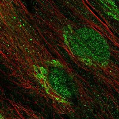 Immunocytochemistry/ Immunofluorescence: PTOP Antibody [NBP1-90181]