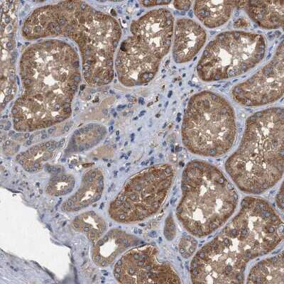 Immunohistochemistry-Paraffin: PTOP Antibody [NBP1-90181]