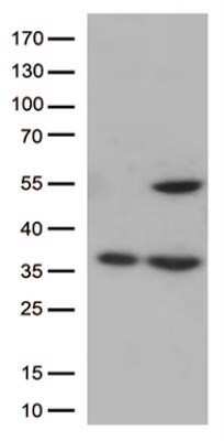 Western Blot: PTOP Antibody (OTI2D5)Azide and BSA Free [NBP2-73711]