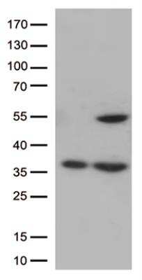 Western Blot: PTOP Antibody (OTI2D5) [NBP2-46216]