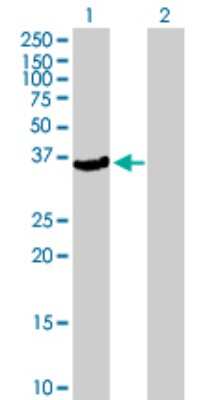 Western Blot: PTOP Antibody [H00065061-B01P]