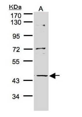 Western Blot: PTOP Antibody [NBP1-32165]