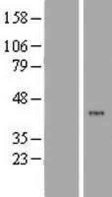 Western Blot: PTOP Overexpression Lysate [NBP2-05596]