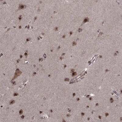 Immunohistochemistry: PTOV1 Antibody [NBP2-68998]