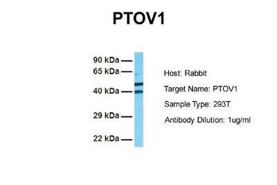 Western Blot: PTOV1 Antibody [NBP1-79384]