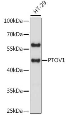 Western Blot: PTOV1 AntibodyAzide and BSA Free [NBP2-93875]