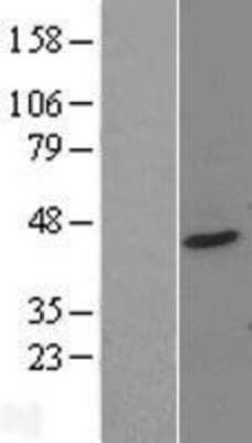 Western Blot: PTOV1 Overexpression Lysate [NBL1-14958]