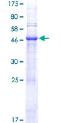 SDS-PAGE: Recombinant Human PTOV1 GST (N-Term) Protein [H00053635-P01]