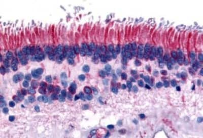 Immunohistochemistry-Paraffin: PTP mu/PTPRM Antibody [NBP3-14457]