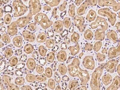 Immunohistochemistry-Paraffin: PTP-MEG2/PTPN9 Antibody [NBP2-97268]