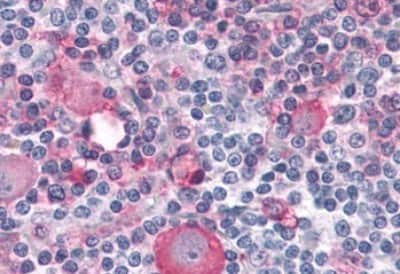 Immunohistochemistry-Paraffin: PTP alpha/PTPRA Antibody [NBP3-14454]