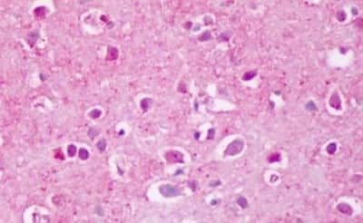 Immunohistochemistry-Paraffin: PTP alpha/PTPRA Antibody [NBP3-14454]