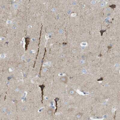 Immunohistochemistry-Paraffin: PTP beta/zeta/PTPRZ Antibody [NBP1-80916]