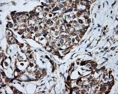 Immunohistochemistry-Paraffin: PTP epsilon Antibody (OTI5F2) [NBP2-02374]