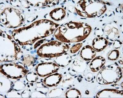 Immunohistochemistry-Paraffin: PTP epsilon Antibody (OTI5F2) [NBP2-02374]