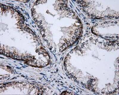 Immunohistochemistry-Paraffin: PTP epsilon Antibody (OTI5F2) [NBP2-02374]