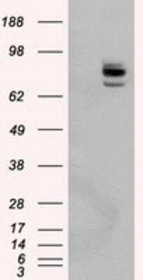 Western Blot: PTP epsilon Antibody (OTI5F2) [NBP2-02374]