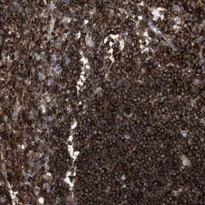 Immunohistochemistry-Paraffin: PTP epsilon Antibody [NBP1-87190]