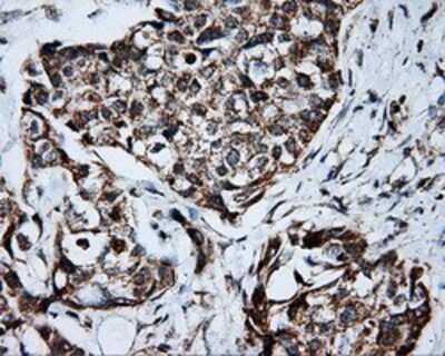 Immunohistochemistry: PTP epsilon Antibody (OTI5F2) - Azide and BSA Free [NBP2-73713]