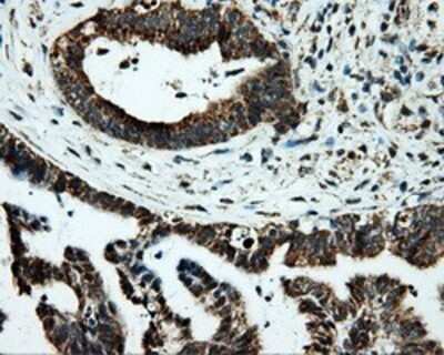Immunohistochemistry: PTP epsilon Antibody (OTI5F2) - Azide and BSA Free [NBP2-73713]