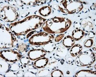 Immunohistochemistry: PTP epsilon Antibody (OTI5F2) - Azide and BSA Free [NBP2-73713]