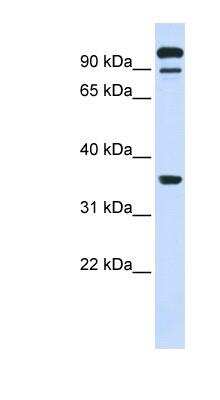 Western Blot: PTP epsilon Antibody [NBP1-62460]