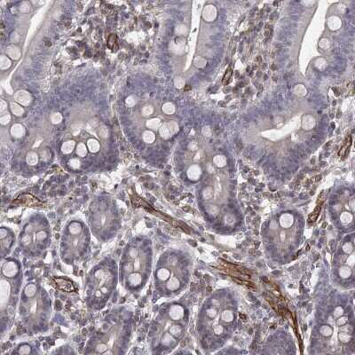 Immunohistochemistry-Paraffin: PTP gamma/PTPRG Antibody [NBP2-57477]