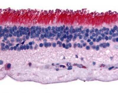 Immunohistochemistry-Paraffin: PTP mu/PTPRM Antibody - BSA Free [NB110-39013]