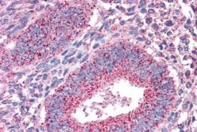 Immunohistochemistry-Paraffin: PTP mu/PTPRM Antibody [NB100-79867]