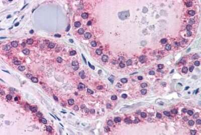 Immunohistochemistry-Paraffin: PTP mu/PTPRM Antibody [NB100-79867]