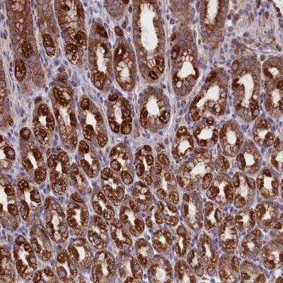 Immunohistochemistry-Paraffin: PTP pi/PTPRU Antibody [NBP1-81873]