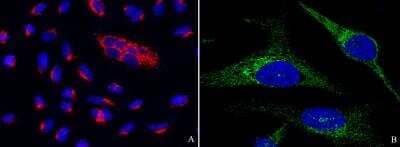 Immunocytochemistry/ Immunofluorescence: PTP1B/PTPN1 Antibody (001) [NBP2-89399]