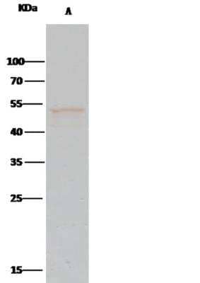 Immunoprecipitation: PTP1B/PTPN1 Antibody (226) [NBP2-89400]