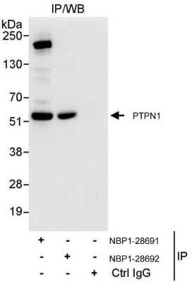 Immunoprecipitation: PTP1B/PTPN1 Antibody [NBP1-28691]