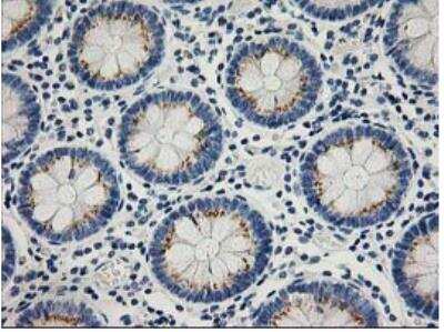 Immunohistochemistry-Paraffin: PTP1B/PTPN1 Antibody (OTI1D10) - Azide and BSA Free [NBP2-73729]