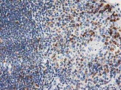 Immunohistochemistry-Paraffin: PTP1B/PTPN1 Antibody (OTI1D10) - Azide and BSA Free [NBP2-73729]