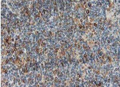 Immunohistochemistry-Paraffin: PTP1B/PTPN1 Antibody (OTI1D10) - Azide and BSA Free [NBP2-73729]