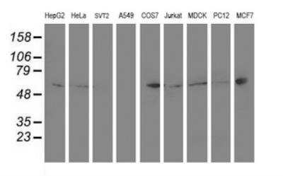 Western Blot: PTP1B/PTPN1 Antibody (OTI1D10)Azide and BSA Free [NBP2-73729]
