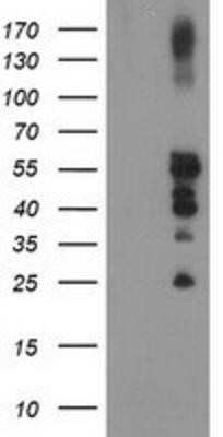 Western Blot: PTP1B/PTPN1 Antibody (OTI1D10)Azide and BSA Free [NBP2-73729]