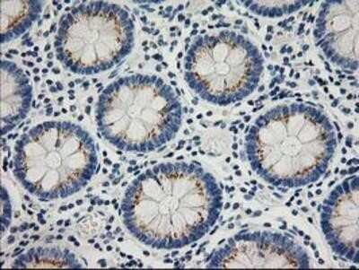 Immunohistochemistry-Paraffin: PTP1B/PTPN1 Antibody (OTI1D10) [NBP2-01056]