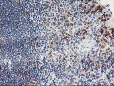 Immunohistochemistry-Paraffin: PTP1B/PTPN1 Antibody (OTI1D10) [NBP2-01056]