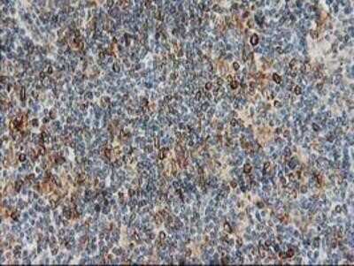 Immunohistochemistry-Paraffin: PTP1B/PTPN1 Antibody (OTI1D10) [NBP2-01056]