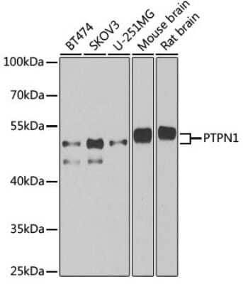 Western Blot: PTP1B/PTPN1 AntibodyAzide and BSA Free [NBP3-03634]