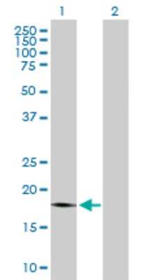 Western Blot: PTP4A1 Antibody [H00007803-B01P]