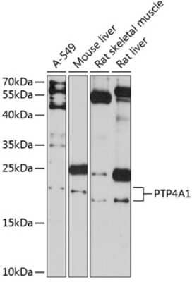 Western Blot: PTP4A1 AntibodyAzide and BSA Free [NBP2-93981]