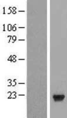 Western Blot: PTP4A1 Overexpression Lysate [NBL1-14959]